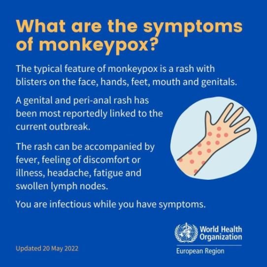 Monkeypox